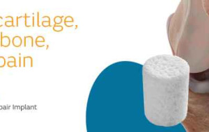 New data for Smith+Nephew’s CARTIHEAL◊ AGILI-C◊ Cartilage Repair Implant demonstrates superior pain relief and functional gains at 5-years