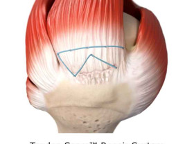Image: Smith+Nephew to feature leading rotator cuff repair portfolio including new Tendon Seam™ Repair System and REGENETEN◊ Bioinductive Implant at AAOS 2026